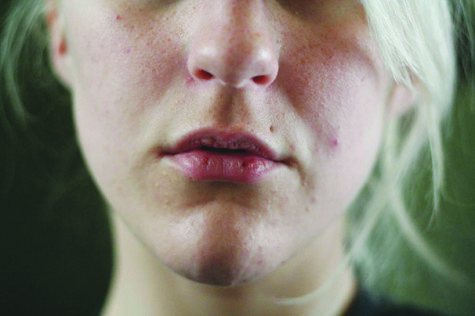 Remedies to protect lips from winter weather