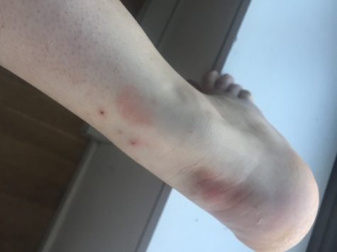 Bed Bugs Infest Gramercy Green