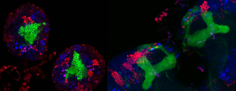 Researchers Inch Closer to Epilepsy Treatment