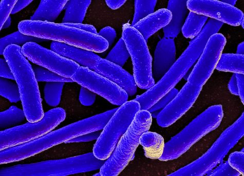 NYUAD Students Win Gold for Portable E. coli Detection Device