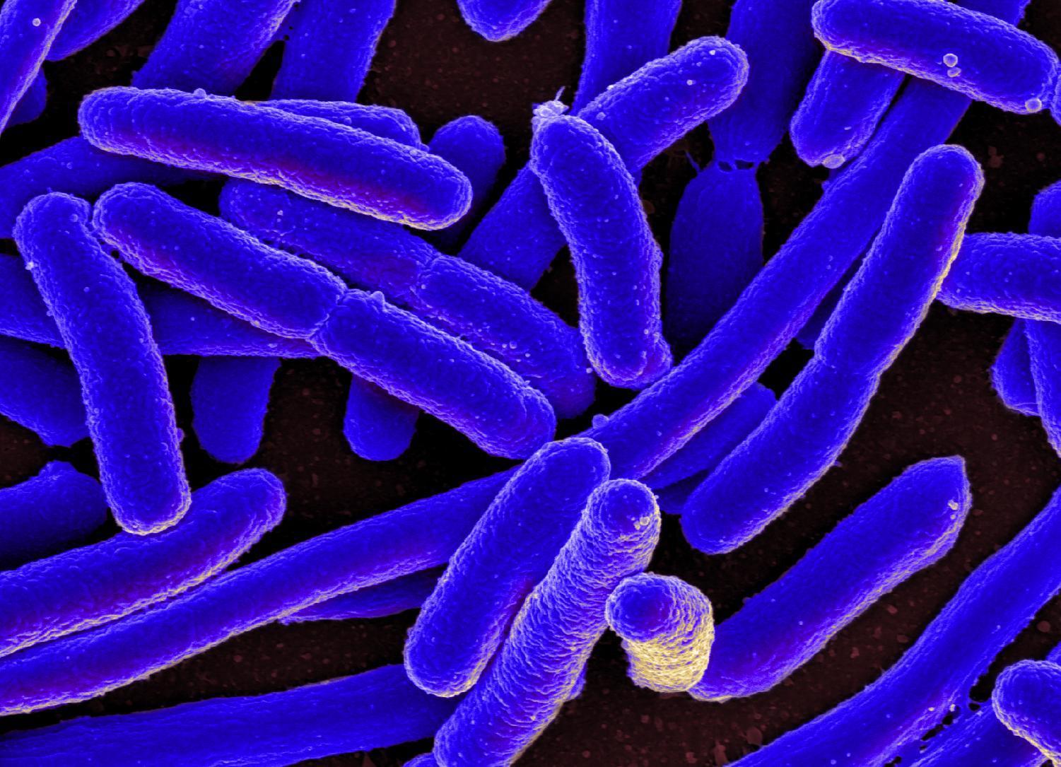 Colorized scanning electron micrograph of E. Coli bacteria. NYUAD students' have created an affordable device that detects E. Coli in twenty minutes.