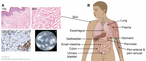 Langone Discovered New Organ in the Human Body